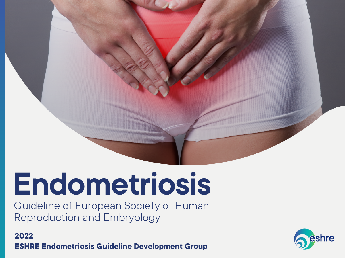 Mais novo guideline Europeu sobre endometriose trazendo o uso de gestrinona entre as opções terapêuticas